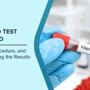 Vitamin D Test Booking