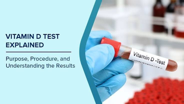 Vitamin D Test Booking